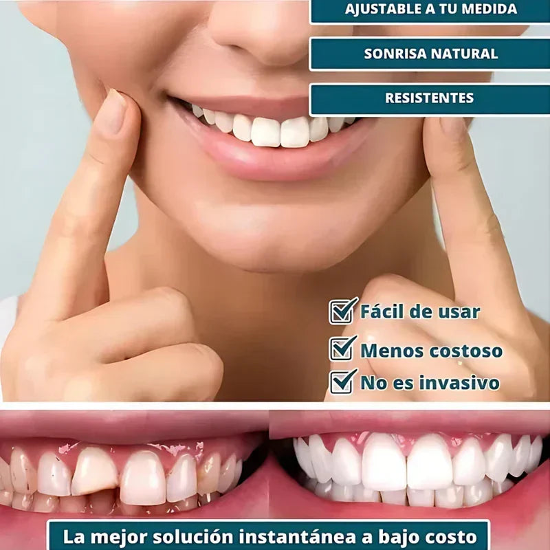 SmilePro 🦷 - Carillas Dentales Ajustables De Resina + ESTUCHE REGALO - 🔥 Oferta Especial