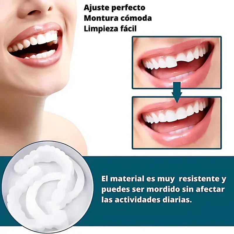 SmilePro 🦷 - Carillas Dentales Ajustables De Resina + ESTUCHE REGALO - 🔥 Oferta Especial