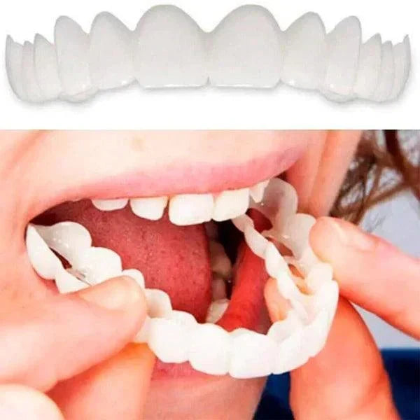 SmilePro 🦷 - Carillas Dentales Ajustables De Resina + ESTUCHE REGALO - 🔥 Oferta Especial