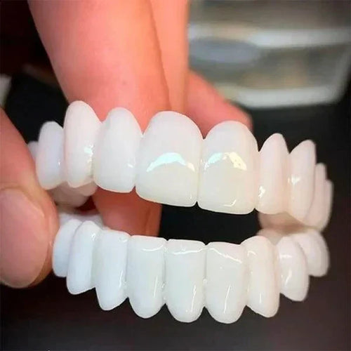 SmilePro 🦷 - Carillas Dentales Ajustables De Resina + ESTUCHE REGALO - 🔥 Oferta Especial